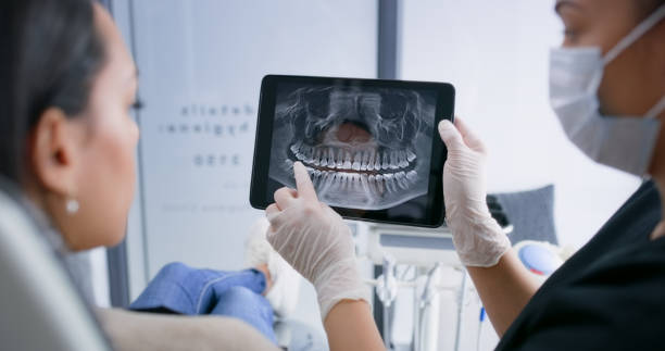 Licensed Teeth Cleaning And Checkup service in Marina del Rey, CA - Smile Center Dentistry